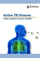 Active TB Disease