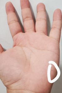 An open palm showing a barely visible bat bite mark